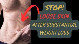 How To STOP LOOSE SKIN After Substantial Weight Loss [upl. by Raycher]