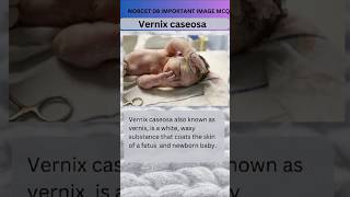 Vernix caseosa Norcet 08 important image Base mcq  Maternity nursingytviralshort [upl. by Hedberg311]