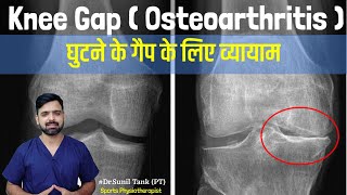 Knee gap exercises in hindi  exercise for knee pain  knee osteoarthritis pain  Dr Sunil Tank [upl. by Ahsiele395]