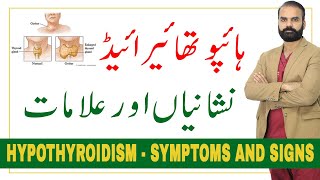 Hypothyroidism Symptoms and signs in UrduHindi [upl. by Elma]