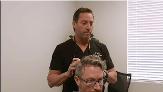 Darrens Hair Restoration Consultation with Dr Glenn Charles  Part 1 [upl. by Meave]