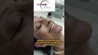 ZIRCONIA Smile Transformation for Front Teeth smile [upl. by Azyl]