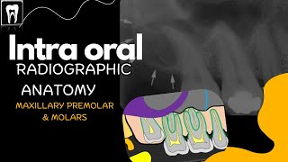 Intra Oral Anatomy Normal radiographic anatomical landmarksMaxilla premolar and molar region [upl. by Greenquist]