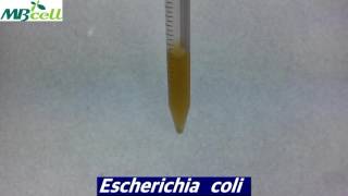 Enterobacteriaceae Enrichment Broth [upl. by Lrem]