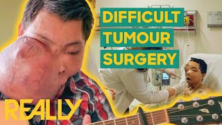 Doctors Remove 3Kg Tumour From A Mans Face  Body Bizarre [upl. by Filip948]