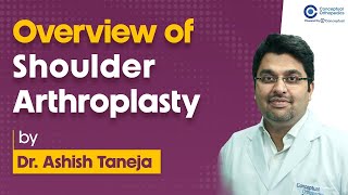 Overview of Shoulder Arthroplasty by Dr Ashish Taneja  Orthopedic Residency  e conceptual [upl. by Abehs]