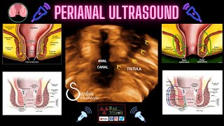 PERIANAL ULTRASOUND [upl. by Rexanna326]