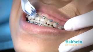 Orthodontic Home Care Instructions  Braces  Brushing [upl. by Egiap482]