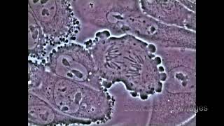 Mitosis in an animal cell Under the Microscope [upl. by Schreib]