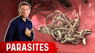 The Best Herbs for Parasites [upl. by Aiderfla]