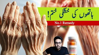 Dr Zee1 Absolute Best Remedy for Dry and Wrinkled Hands उत्तम उपाय [upl. by Hastings]