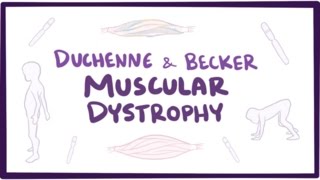 Duchenne amp Becker muscular dystrophy  causes symptoms treatment amp pathology [upl. by Noah]