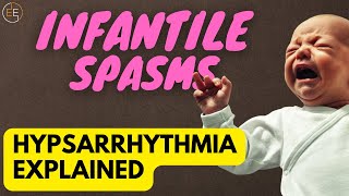 The Terrifying Truth About Infantile Spasms [upl. by Marala]