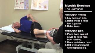 Myositis Exercises Clamshell V5 1 [upl. by Aiuqat]