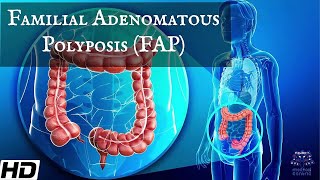 Familial Adenomatous Polyposis  FAP Everything You Need To Know [upl. by Benedix558]