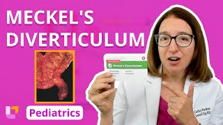 Meckels Diverticulum Alterations in Health  Gastrointestinal Pediatrics  LevelUpRN [upl. by Asyla]