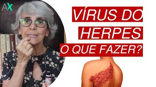 O que fazer com o vírus do herpes [upl. by Sirromaj]