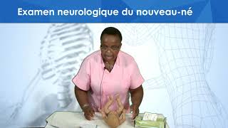 Examen neurologique du nouveau né [upl. by Ahsataj628]