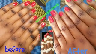 CLEAR DARK KNUCKLES INSTANTLY AT HOME see result Live in video 100 working [upl. by Annaoi885]