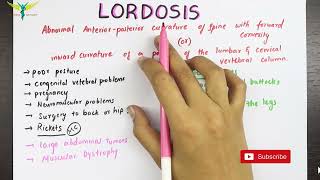 Lordosis  Medical Symptomatology [upl. by Haneeja129]