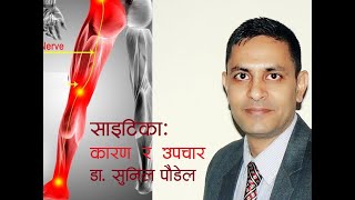 साइटिका कारण र उपचार Sciatica Dr Sunil Paudel बिना अप्रेसन [upl. by Enialem]