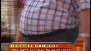 Alli Weight Loss Warning [upl. by Olli]