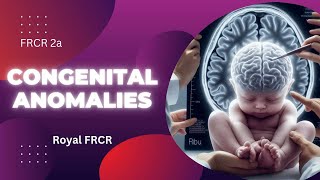 2  Neuroimaging for FRCR [upl. by Anrehs82]