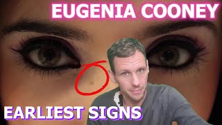 Warning signs in Eugenia Cooneys earliest content [upl. by Ettezzus]