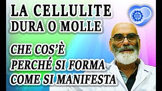 La Cellulite  Che Cosè Come si Forma Come Riconoscerla [upl. by Niroht745]