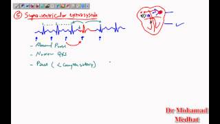 Arrhythmia ECG Dr Mohamad Medhat [upl. by Aihtnys734]