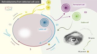 Retinoblastoma from defected cell cycle [upl. by Letsirhc]