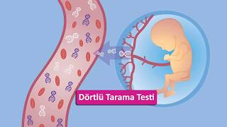 Dörtlü tarama testi nasıl yorumlanır ne zaman ve ne için yapılır Down sendromu spina bifida [upl. by Ethben434]