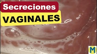 SECRECIONES VAGINALES por Hongos Parásitos y Virus [upl. by Breban]