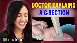 Doctor Uses 3D Animation to Explain CSection [upl. by Nelyaw198]