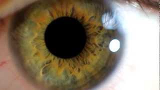 Close up eye and pupil dilation [upl. by Adiahs]