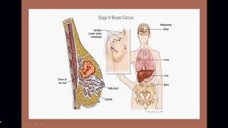 Applied Therapeutics II Lecture of Breast Cancer [upl. by Gayla]