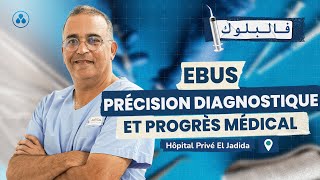 Hôpital Privé El Jadida  EBUS  Précision diagnostique et progrès médical [upl. by Assilla57]