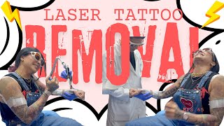 A Typical Laser Tattoo Removal Session [upl. by Mourant]