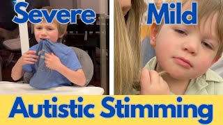 12 Examples of Autism Stimming [upl. by Jarrid219]