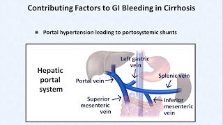 Esophageal Varices and Variceal Hemorrhage [upl. by Laws]