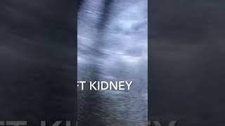 Bilateral Renal Parenchyma Disease Grade 2 ultrasound video viral shorts like subscribe [upl. by Niret]