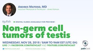 Nongerm cell tumor of testis  Dr Matoso Hopkins GUPATH [upl. by Ynnej]