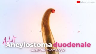 Adult Ancylostoma duodenale under the microscope [upl. by Aldous]