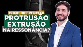 Hérnia de disco protrusão ou extrusão Médico Radiologista explica em detalhes  Galvani Filho [upl. by Airym]