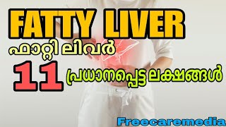 Fatty liver symptoms malayalam  liverdisease liver liverdiseasesymptoms [upl. by Secilu461]