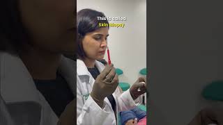 Skin Biopsy 💉🧏‍♀️ Procedure By Dermatologist  Dr Priyanka Reddy  DNA Skin Clinic  shorts [upl. by Aihselef]