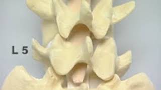 Pedicle Identification spine surgery YouTube [upl. by Eelsew448]