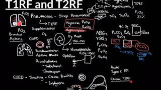 Type 1 and Type 2 Respiratory Failure Part 3 [upl. by Assecnirp]