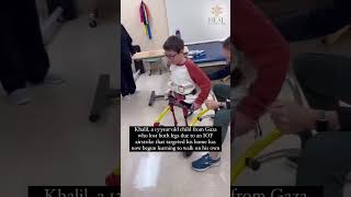 Khalil a child from Gaza has begun learning how to walk again after being evacuated gaza shorts [upl. by Campagna]