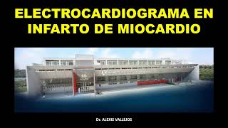 ELECTROCARDIOGRAMA EN INFARTO DE MIOCARDIO II [upl. by Aloeda]